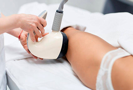 VelaShape